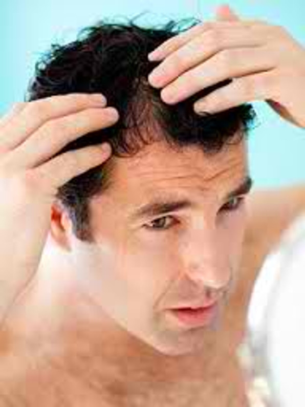 NATURAL WAY TO STOP MALE PATTERN HAIR LOSS