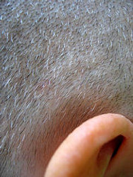 VITAMINS FOR HEALTHIER HAIR AND SCALP