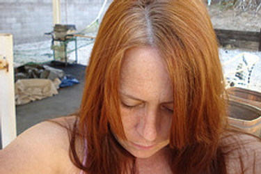 HAIR LOSS FOLLOWING PREGNANCY