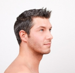 NISIM BIOFACTORS: THE SAFE WAY TO TREAT HAIR LOSS