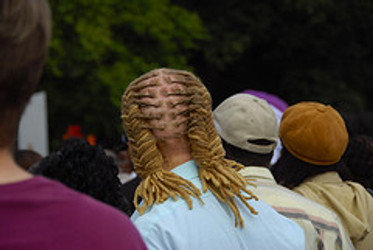 DO CERTAIN HAIR STYLES CAUSE HAIR LOSS?