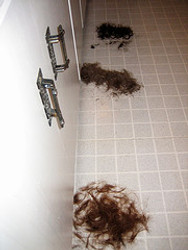 TYPICAL CAUSE OF HAIR LOSS IN WOMEN