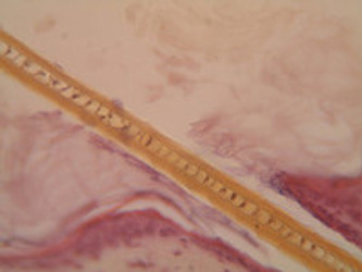 FACTORS BEHIND HAIR LOSS AND HOW TO TREAT IT