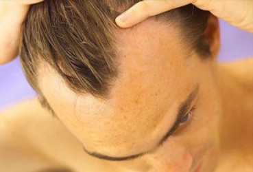 MAIN REASONS WHY ANDROGENETIC ALOPECIA IS SO DIFFICULT TO TREAT