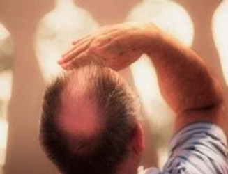 WHAT ARE THE CAUSES OF HAIR LOSS?