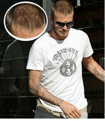 THEN IT WAS ROONEY, NOW IT’S BECKHAM! . . . WHO’S NEXT?