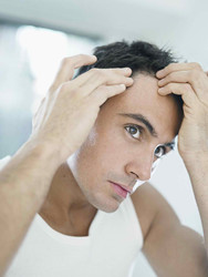 WHEN YOU LOSE HAIR IN YOUR 20S