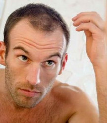 FIND OUT HOW TO PREVENT HAIR LOSS