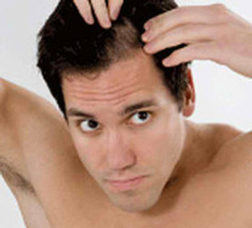 HOW TO NATURALLY STOP HAIR LOSS