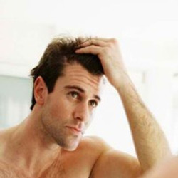 NATURAL WAYS TO PREVENT HAIR LOSS