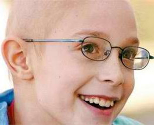 ANDROGENETIC ALOPECIA IN CHILDREN