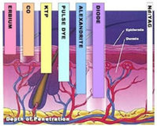 WHAT TYPES OF LASER HAIR REMOVAL TECHNOLOGY EXIST?
