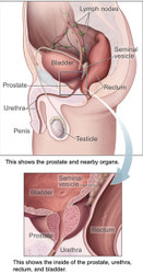  EARLY HAIR LOSS OCCURRENCE COULD BE AN EARLY SIGN OF PROSTATE CANCER
