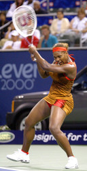 SERENA WILLIAMS SEEN WITH A PATCH OF HAIR LOSS