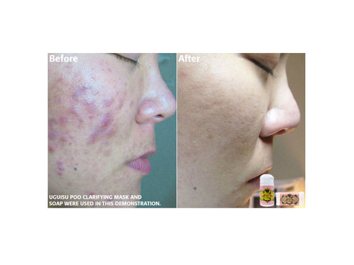 Uguisu No Fun Clarifying Soap 80g