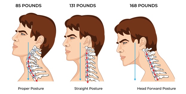 Varieties of Posture