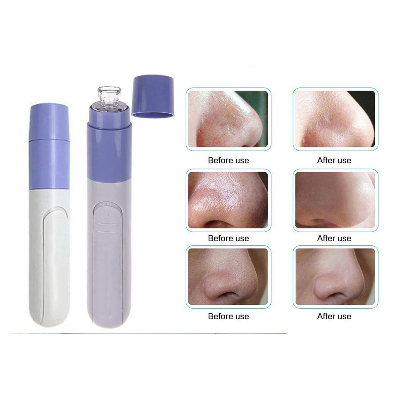 Anti-Aging Skin Care Smoothing Facial Massager and Pore Cleanser product image