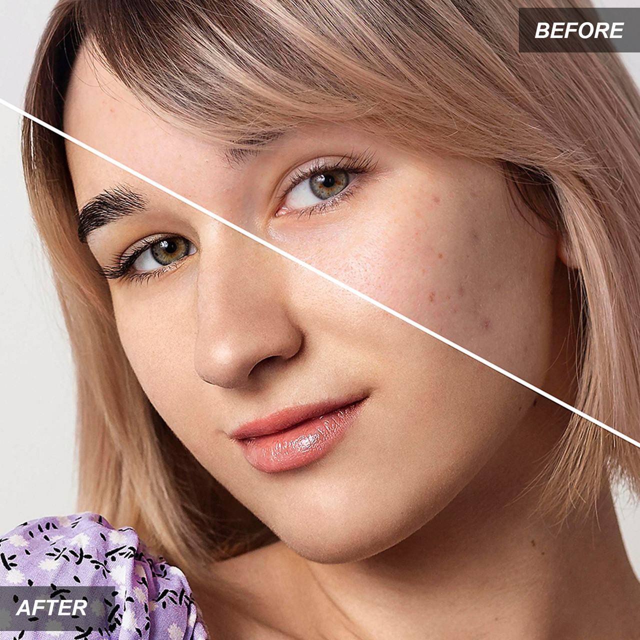 Anti-Aging Skin Care Smoothing Facial Massager and Pore Cleanser product image