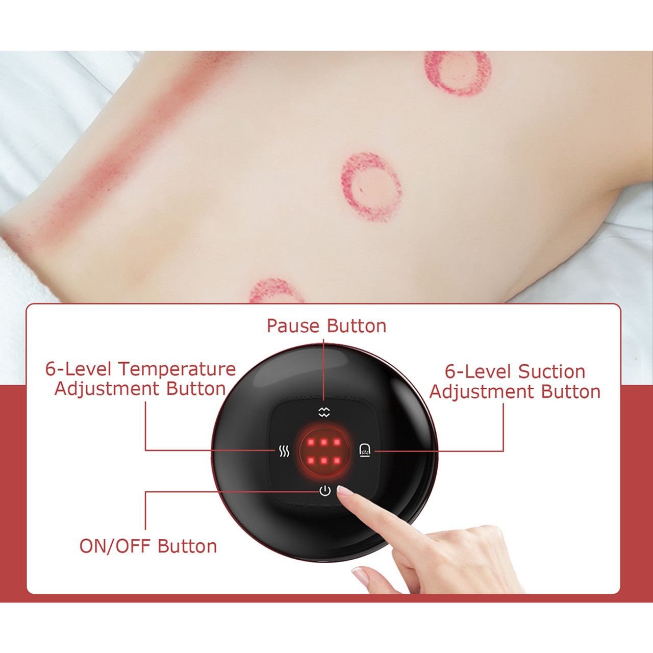iMounTEK® Electric Cupping Back Massager product image