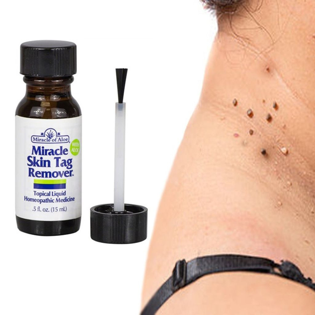 Miracle of Aloe® Homeopathic Miracle Skin Tag Remover (1- or 2-Pack) product image