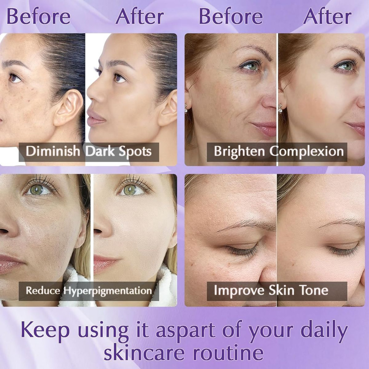 Dark Spot Remover for Face product image