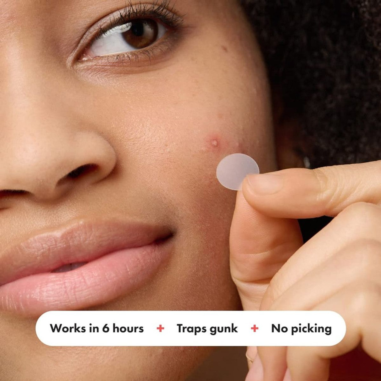 Mighty Patch Hydrocolloid Acne Pimple Patch (5-Pack) product image