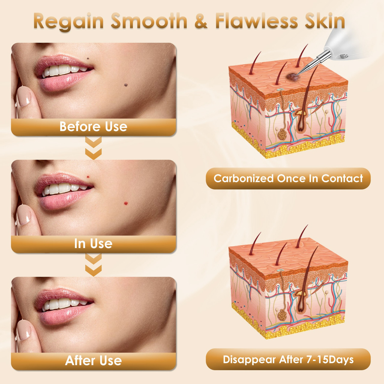 Electronic Ion Skin Tag Repair Kit  product image