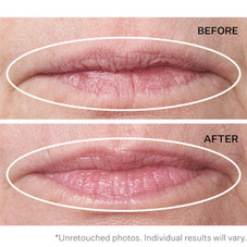 StriVectin® Double Fix™ for Lips Plumping & Vertical Line Treatment, 0.16 fl. oz. product image