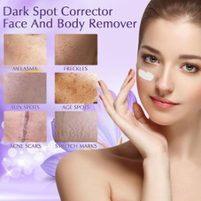 Dark Spot Remover for Face product image