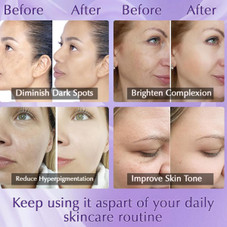 Dark Spot Remover for Face product image