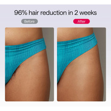 Ulike Air 10 IPL Hair Removal Device product image