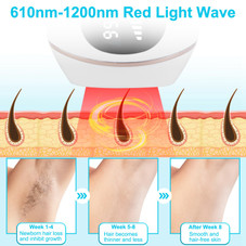 IPL Laser Hair Remover product image