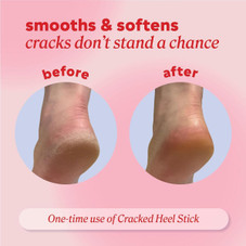 Onyx Professional Cracked Heel Treatment (2-Pack) product image
