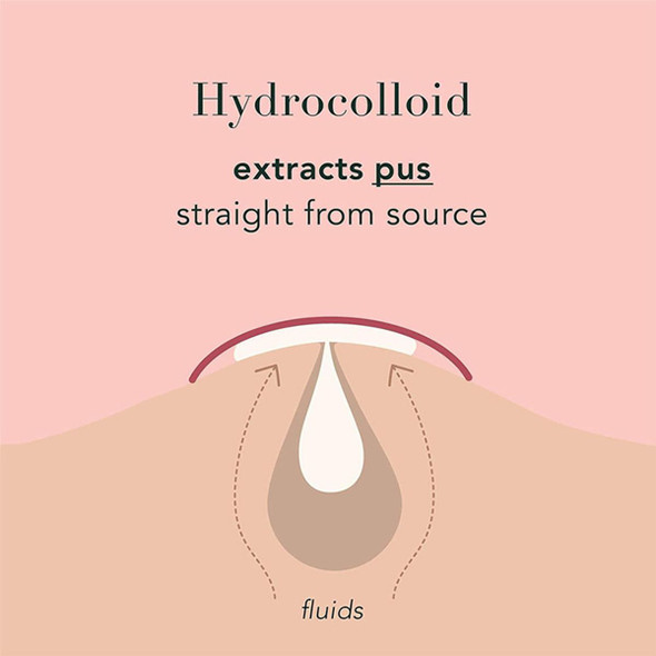 Invisible Hydrocolloid Acne Patches (96-Count) product image