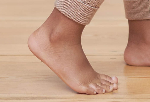 Are sweaty feet normal?