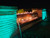 Large Formal Falls® Retaining Wall Installed with Lights