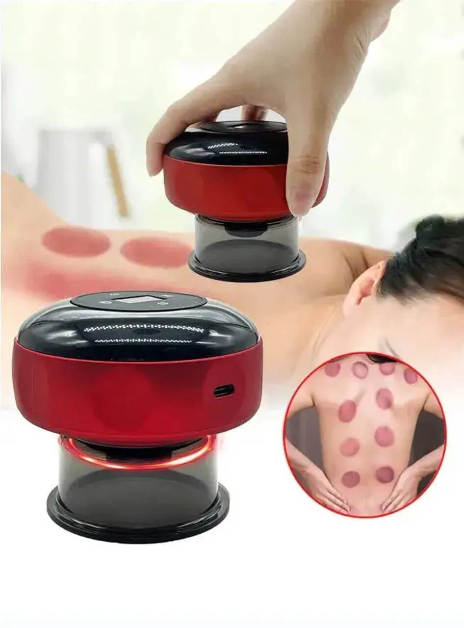 Smart Vacuum Cupping Massager - Heat & Advanced Suction