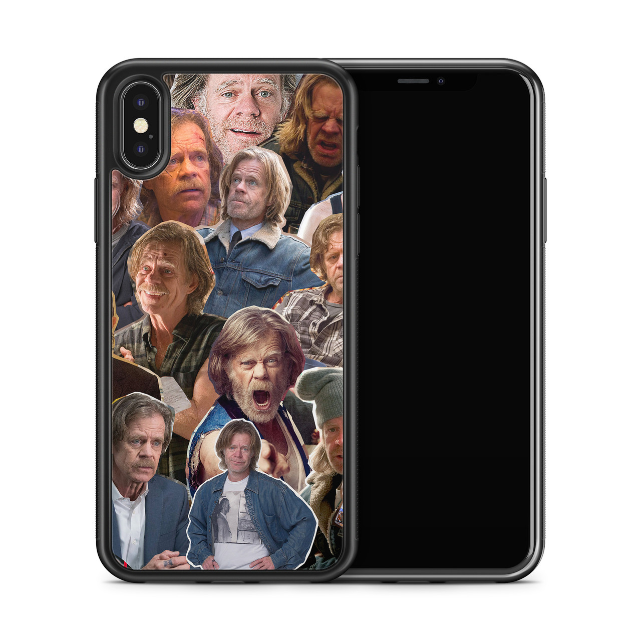 Frank Gallagher (Shameless) Phone Case