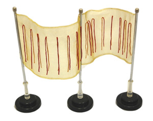 Screen Electroscope: Charge Distribution Electroscope Screen Electroscope: Charge Distribution Electroscope