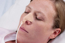 Dale Medical Products Inc DaleNasoGastric Tube Holder One Size fits most