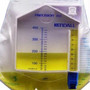 Kendall Dover Precision 400 Urine Meter with Luer-Lock Sampling, Safeguard 400mL, Extra-Long 60" Tubing