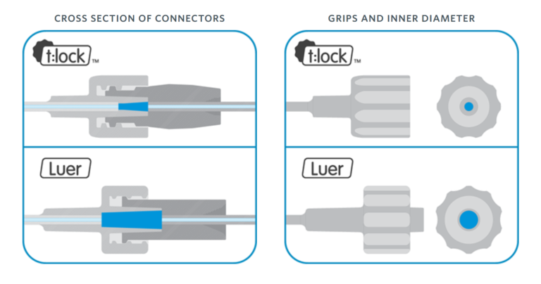 infusion site for insulin pump with tubing. This pictures shows an