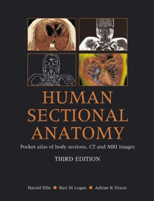 Human Sectional Anatomy: Pocket Atlas of Body Sections, CT and MRI Images, Third Edition