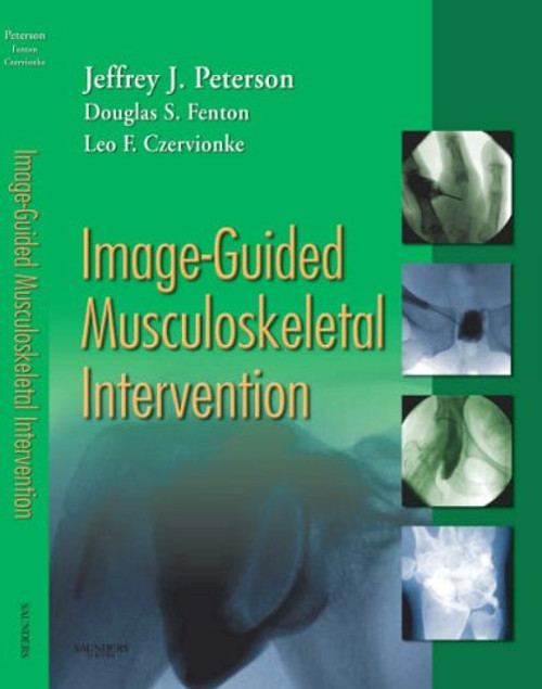 Image-Guided Musculoskeletal Intervention, 1e