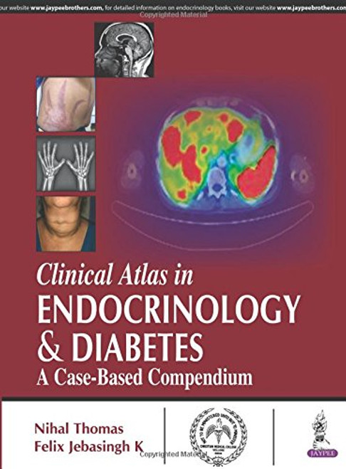 Color Atlas of Endocrinology & Diabetes