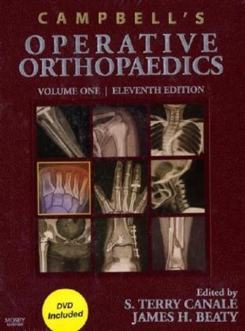 Campbell's Operative Orthopaedics: 4-Volume Set with DVD, 11e