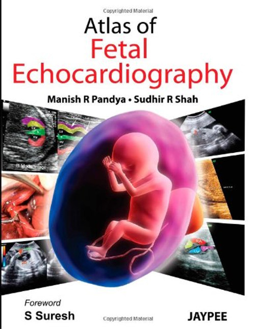 Atlas of Fetal Echocardiography