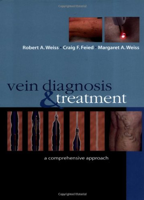 Vein Diagnosis & Treatment: A Comprehensive Approach