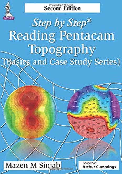 Step by Step Reading Pentacam Topography (Step by Step: Basics and Case Study)