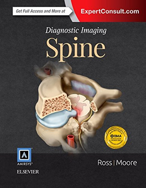 Diagnostic Imaging: Spine, 3e